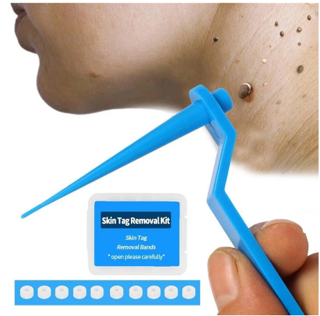 Skin Tag Doden Huid Mol Wratten Remover Micro Band Huid Tag Removal Kit Volwassen Mol Wratten Gezich